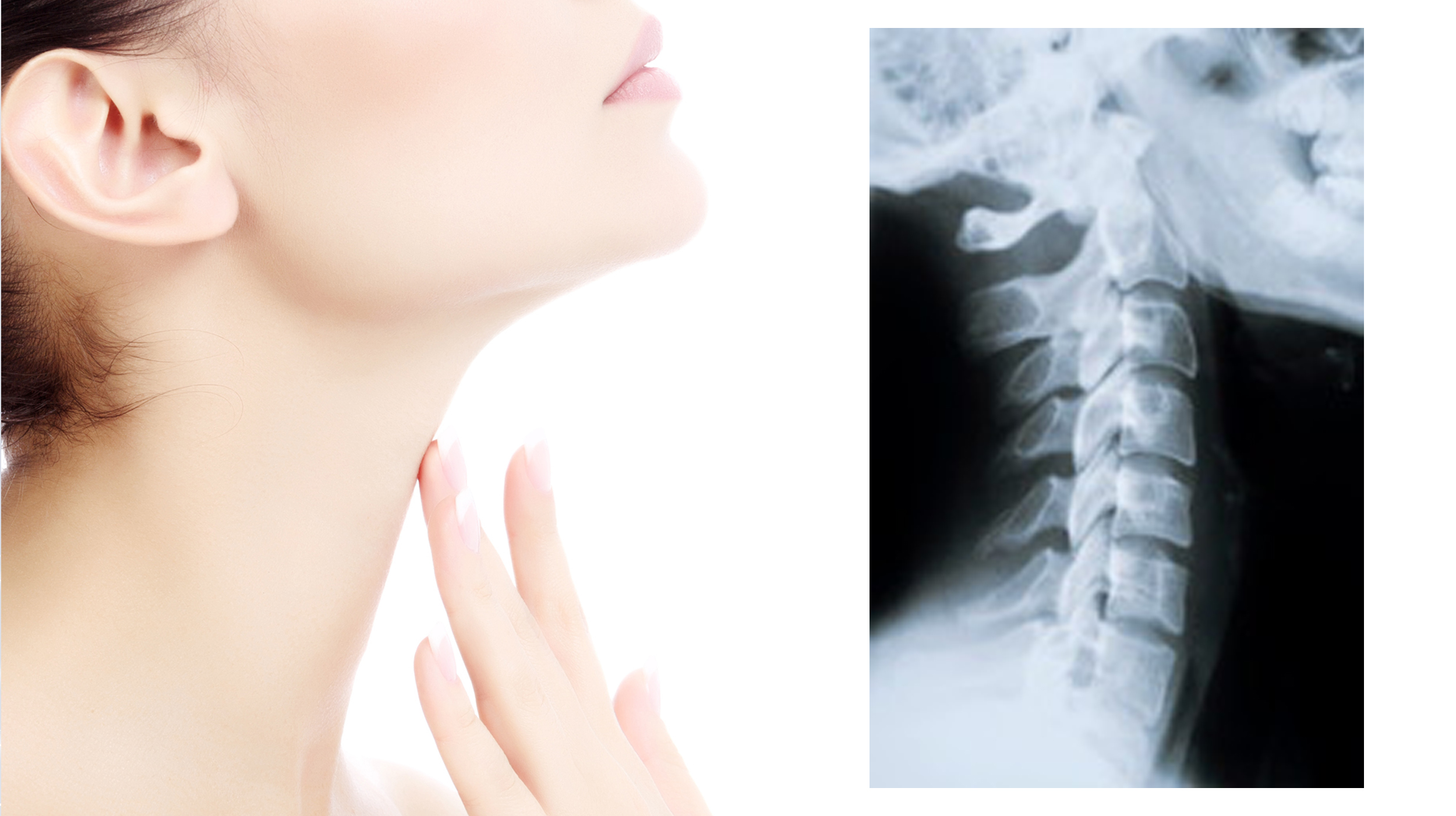 首のイメージ写真